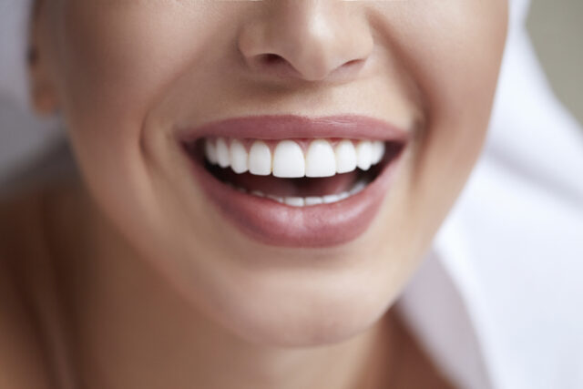 Healthy white smile close up. Beauty woman with perfect smile, l