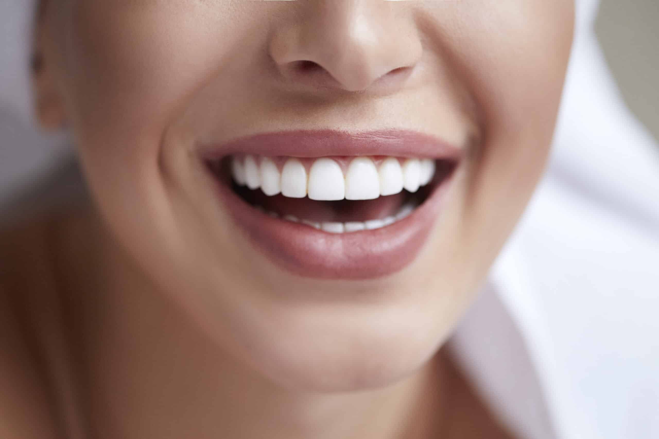 Healthy white smile close up. Beauty woman with perfect smile, lips and teeth. Beautiful Model Girl with perfect skin. Teeth whitening.