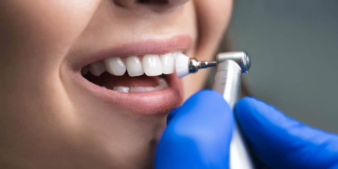 Die professionelle Zahnreinigung